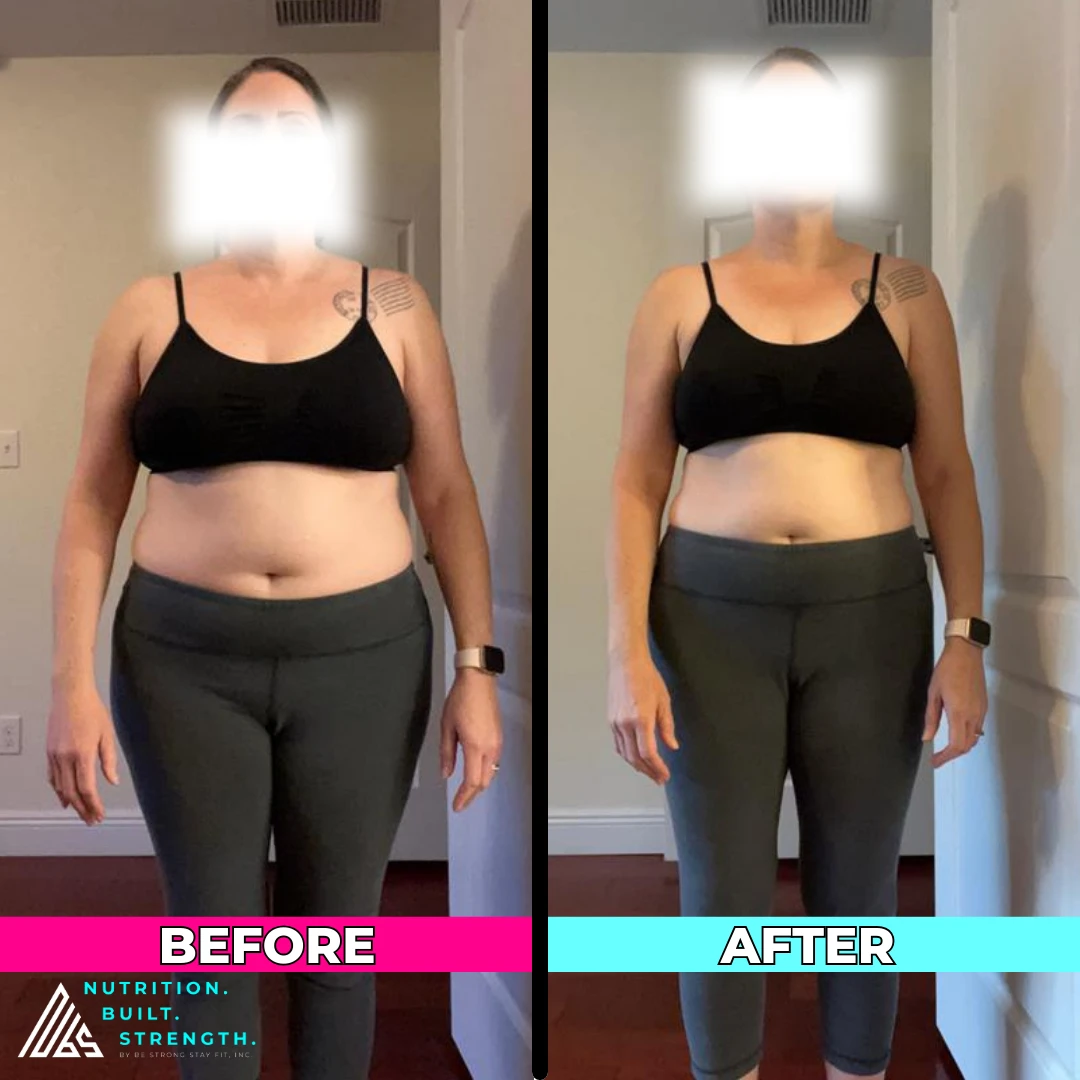 Anne L.’s real NBS progress shown from the front
