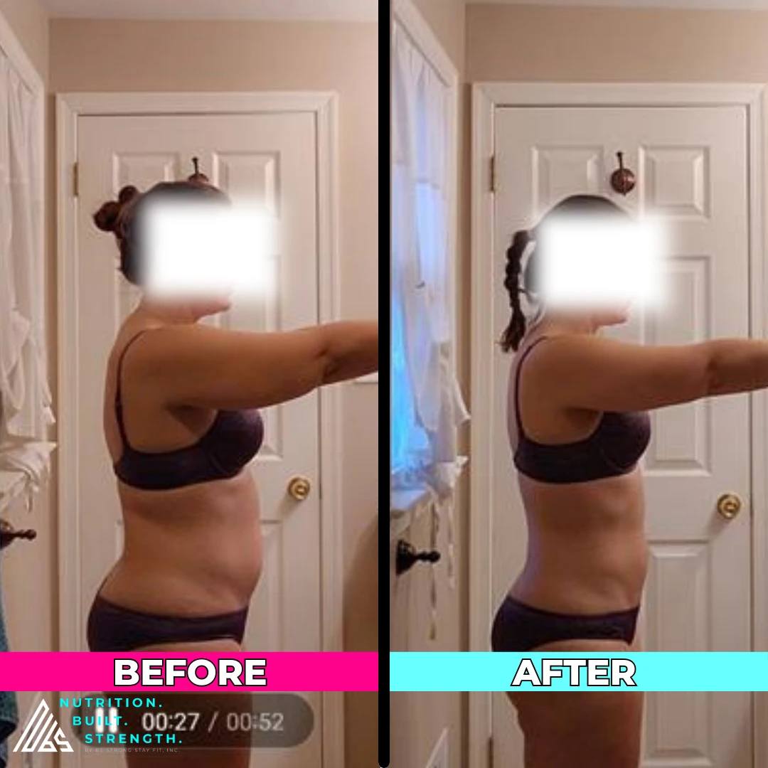 Dana G.’s real NBS progress shown from the front
