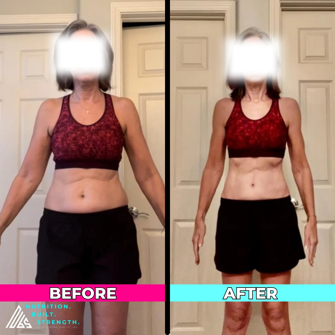 Karen B.’s real NBS progress shown from the front